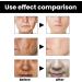 Aobenz Spot Remover for Face Anti Spot Serum Dark Spot Correcting Serum Sun Spot Dark Spot Remover Age Spot Treatment Face Serum Skin Whitening Spot and Freckle Remover Spot Treatment for Face 50ml - Buy Online on GoSupps.com