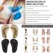 3Pairs Arch Support Shoe Insoles for Flat Feet & Plantar Fasciitis Washable Gel Arch Support Pads for Women Men Kids High Heel Inserts Cushion Pads for Foot Pain - Buy Online on GoSupps.com