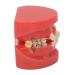 24-Teeth Ceramic Orthodontic Model with Wires & Brackets for Dental Training - International Shipping Available - Buy Online on GoSupps.com