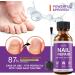 PURE GROWN BY NATURE Pureskin Nail Repair - 1.7 Oz. - Buy Online on GoSupps.com