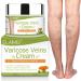 Varicose Veins Cream, Varicose Vein Soothing Leg Cream, Relief Phlebitis Vein Treatment Legs spider Veins Improves the Appearance of Leg Relieves Varicose Vein Discomfort Pain Strain