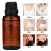 Breast Essential Oil for Hyperplasia Relief | Pain-Relieving 30 ml Care for Mammary Glands - Buy Online on GoSupps.com