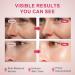 Pink Salmon DNA PDRN Serum Korean Skin Care Niacinamide & Hyaluronic Acid Face Serum with Peptides Hydrating Peptide Serum for Facial SkinCare - Buy Online on GoSupps.com