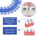 Braces Separator - 700 PCS Teeth Elastic Orthodontic Ligature Ties Rubber Bands for Effective Dental Care - Buy Online on GoSupps.com