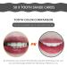 Exceart 50-Piece Tooth Shade Shadow Card Set for Dental Color Comparison | International Shipping - Buy Online on GoSupps.com