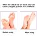 Electric Foot Files Callus Remover For Callus Remover For Feet Rechargeable Foot Grinder For Cracked Feet Electric Foot File Hard For Callus Shavers With Heels And Dead Skin - Buy Online on GoSupps.com