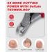 Softale Toenail Clippers for Thick Nails - Professional Stainless Steel Podiatrist Pedicure Kit for Ingrown Toenails - 7 Piece Set in Red+Silver - Buy Online on GoSupps.com