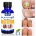 Nail Fungal Treatment - Extra Strength Cure for Toenail Fungus - Buy Online on GoSupps.com