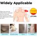 3pcs Lipoma Removal Cream for Anti-Swelling & Cellulite Elimination | Lymphatic Ointment for Lipoma Exfoliation - Buy Online on GoSupps.com