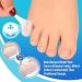 30 Pcs Silicone Anti-Friction Toe Protectors with Breathable Holes - Protect Toenails, Corns, Blisters, Hammer Toes - Men and Women - Buy Online on GoSupps.com