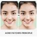 Buy Invisible Hydrocolloid Acne Patches - Effective Spot Healing for Pimple Treatment | International Shipping Available - Buy Online on GoSupps.com