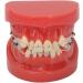 Orthodontic Model 24 Teeth with Metal Wire Case - Ideal for Dental Hospitals | International Shipping Available - Buy Online on GoSupps.com