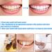 Niacinamide Whitening Toothpaste Utogru Teeth Radiant Whitening Toothpaste - Enamel Care Repair and Protect Teeth Fresh Breath (2Pcs - Buy Online on GoSupps.com