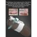Toe Separator & Bunion Corrector | Adjustable Big Toe Bunion Splint for Day & Night Relief - Buy Online on GoSupps.com