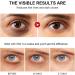 Retinol Eye Cream-Eye Cream For Dark Circles And Puffy Eyes Moisturize Hydrate With Retinol Serum Collagen Hyaluronic Acid-Eye Cream Anti Aging-Anti Wrinkle Eye Cream - Buy Online on GoSupps.com