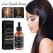 Alopecia Hair Growth Oil for Women & Men | Natural Hair Loss Treatment Serum | Fast-Acting Vegan Scalp Fertilizer - Buy Online on GoSupps.com