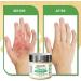 Dermoia Manuka Honey Cream for Seborrheic Dermatitis, Eczema, Psoriasis, Shingles - Soothes Dry, Irritated Skin - Face & Body Relief - 4oz - Buy Online on GoSupps.com