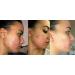 Retinol Gel 0.1 Vitamin A Repairs Fine Lines & Wrinkles Scar Treatment Age and Sun Spots Anti-Aging Formula 20 Grams (Ret_0.1) - Buy Online on GoSupps.com