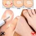 200 Pieces Ingrown Toenails Stickers Toenail Correction Patch Glue-Free Ingrown Curved Toenail Lifter Foot Care Treatment Pedicure Tool (A) - Buy Online on GoSupps.com