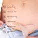 Dermaclara Siliconefusion C-Section Kit - Reusable Silicone Scar Patch for Scars, Wrinkles, Stretch Marks - Pregnancy Safe & Hypoallergenic - Dermatologist Tested - 4 ct - Buy Online on GoSupps.com