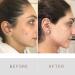 Yon-Ka SOS Spot Acne Treatment Roll On - Natural Lactic Acid Clear Breakouts (7ml) - Buy Online on GoSupps.com