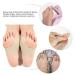 Silicone Bunion Corrector Kit - Pain Relief for Hallux Valgus - Protector Sleeves & Separator Toe Sock (S) - Buy Online on GoSupps.com