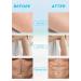 Nano Hair Remover Stone for Women & Men - Crystal Hair Remover Magic Tool for Fast & Easy Hair Removal on Body & Back - Buy Online on GoSupps.com
