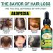 dijiusidy Ginger Hair Growth Oil Prevent Baldness Good-absorption Fast Growing 30MLSerum Nourish Tools Female - Buy Online on GoSupps.com