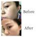 Huangfutang Herbal Formula Skin Cleanup Ointment Cream - 2 Pcs - Buy Online on GoSupps.com
