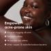 HERO COSMETICS Brave Body Hydrating Mineral Melt - Renew & Smooth Acne-Prone Skin - Shea Butter + Almond Oil - 6.76 Fl. Oz - Buy Online on GoSupps.com