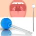 Tonsil Stone Remover Mandelstein removed almond stone cupping glass Tonsillenstein removed almond stones cupping glass with dental mirror for bad breath oral care fresh breath (blue)