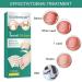 60 Pcs Toenail Correction Patch - Ingrown Toenail Corrector Tools for Perfect Pedicure - Buy Online on GoSupps.com