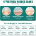 ACWOO Silicone Scar Sheets (1.6 x 40 1M) - Professional Reusable Soft Tape for Scar Removal - C-Section, Surgery, Burn, Keloid, Acne - Painless New and Old Scar Treatment - Buy Online on GoSupps.com