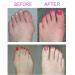 Bunion Corrector Sleeves with Toe Straighteners & Separators | Pain Relief Brace for Hallux Valgus & Hammer Toe | Adjustable & Easy to Wear | Size Small - Buy Online on GoSupps.com