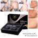 Ofanyia Professional Concealer Set - Waterproof Total Coverage Makeup for Birthmarks, Scars, Vitiligo - Concealer Kit for Flawless Skin - Buy Online on GoSupps.com