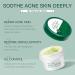 Anti Acne Treatment Tea Tree Face Cream For Spot Treatment Spot Cream For Acne Spot Treatment Acne Cream For Face Reduce Redness & Dryness Oil Control Smooth Skin - Buy Online on GoSupps.com