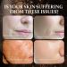 2PCS Peptide Propolis Face Serum Reduce Dryness Firming Lifting Renewal Smoothing Nourishing Repair Damaged Skin Essence  - Buy Online on GoSupps.com