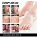 CAOQAO Nail Fix Solution Thickened Bright Nails To Get Rid Of Nail Dead Skin Fix Moisturizing Nail Nutrition Care Solution 30ml Nail Suction (B One Size) 1 count (Pack of 1) B - Buy Online on GoSupps.com