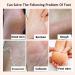 Allbesta Horse Oil Repair Hand Foot Care Exfoliating Cream Anti Frostbite Dry Cracks And Cracks Heal Ointment - Buy Online on GoSupps.com