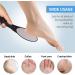 Folai Callus Files - Ergonomic Stainless Steel Horn Skin Remover for Ultimate Foot Care & Pedicure - Non-Slip Handle - Buy Online on GoSupps.com