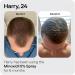 Sons Minoxidil 5% Cutaneous Solution, Hair Regrowth & Thickener Formula - 60ml - Buy Online on GoSupps.com