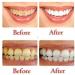 Vista Activated Charcoal Toothpaste 2 Pack | Bamboo Whitening Toothpaste | Eco-Friendly & Refillable | White Teeth - Buy Online on GoSupps.com