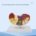 Liver Damage ical Model Liver Pathology Models Teaching Aids - 22.5 * 17 * 16CM - Buy Online on GoSupps.com