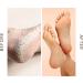 Vitali-Chi Hand & Foot Cream | for Deep Cracked Heels Fungal Conditions and Verrucae - 100ml - Buy Online on GoSupps.com