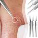 Ultra-fine Professional No. 5 Acne Blackhead Removal Tweezers Beauty Salon Pimples Clip Care Face Deep Needles Cleaner Tool Skin Beak Clip - Buy Online on GoSupps.com