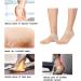 Madholly Gel Heel Sleeves - 5 Pairs | Breathable Silicone Heel Socks for Dry Cracked Heel, Plantar Fasciitis, Achilles Tendonitis, Heel Spurs, Sore Heel - Buy Online on GoSupps.com