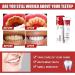 SP-4 Probiotics Brightening Toothpaste - Fresh Breath & Color Correction 5 Count Pack | International Shipping Available - Buy Online on GoSupps.com