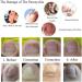 Toenail Tool 6 in 1 Ingrown Toe Nail Fixer Pedicure Toenail Recover Nail Foot Care Kit Ingrown Toenail Corrector for Men Women(24pcs) - Buy Online on GoSupps.com