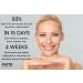 Phyt Age Anti-Aging Face & Neck Cream - Collagen Boosting Moisturizer for Youthful Glow Hydration & Firmness - Reduce Fine Lines & Wrinkles (1.7oz - Buy Online on GoSupps.com