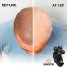 Buy Groomie Cordless Bald Head Shaver for Men - BaldiePro Grooming Kit with SmoothShave Blade 2.0 Cleaning Brush & Charger - International Shipping Available - Buy Online on GoSupps.com
